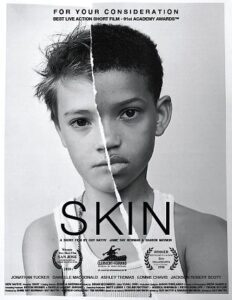 ▹ Skin